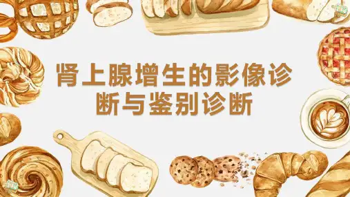 肾上腺增生的影像诊断与鉴别诊断