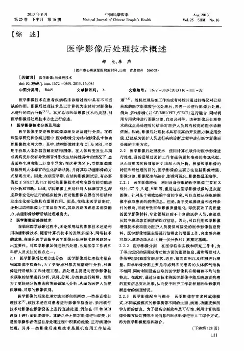 医学影像后处理技术概述
