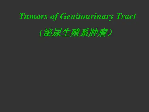 肾肿瘤 英文版-精品医学课件