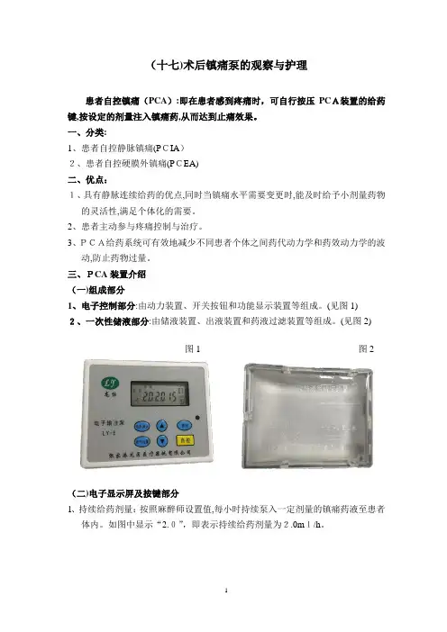 镇痛泵使用
