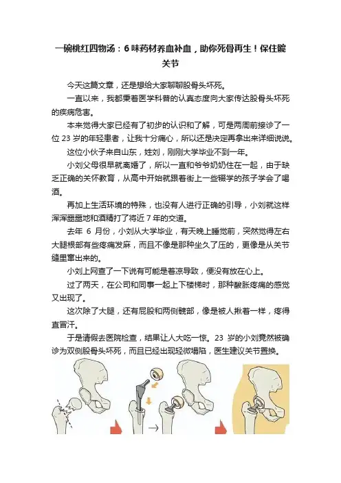 一碗桃红四物汤：6味药材养血补血，助你死骨再生！保住髋关节