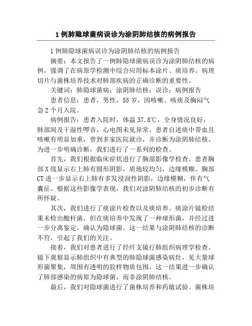 1例肺隐球菌病误诊为涂阴肺结核的病例报告