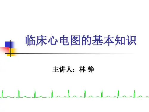 心电图