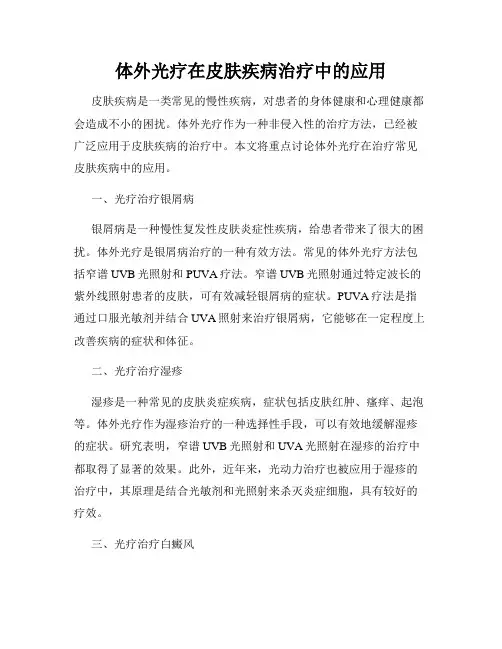 体外光疗在皮肤疾病治疗中的应用