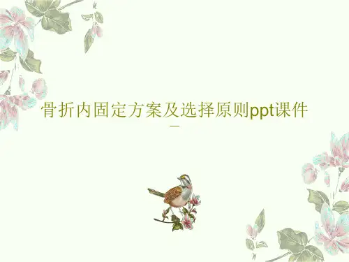 骨折内固定方案及选择原则ppt课件PPT50页