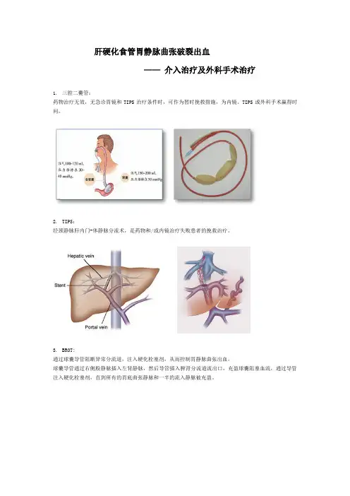 肝硬化食管胃静脉曲张破裂出血 介入治疗及外科手术治疗