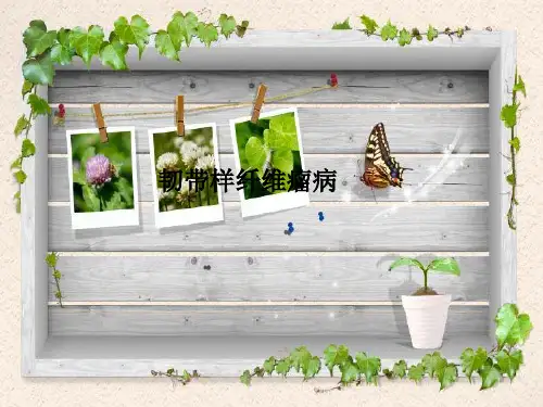 韧带样纤维瘤病
