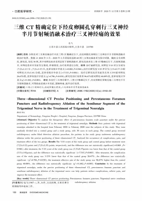 三维CT精确定位下经皮卵圆孔穿刺行三叉神经半月节射频消融术治疗三叉神经痛的效果