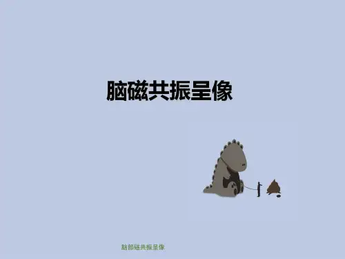 脑部磁共振呈像