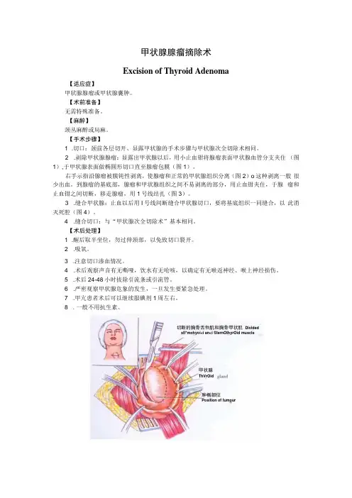 手术图谱资料：甲状腺腺瘤摘除术