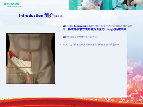 202X年李金斯坦无张力疝手术方法步骤