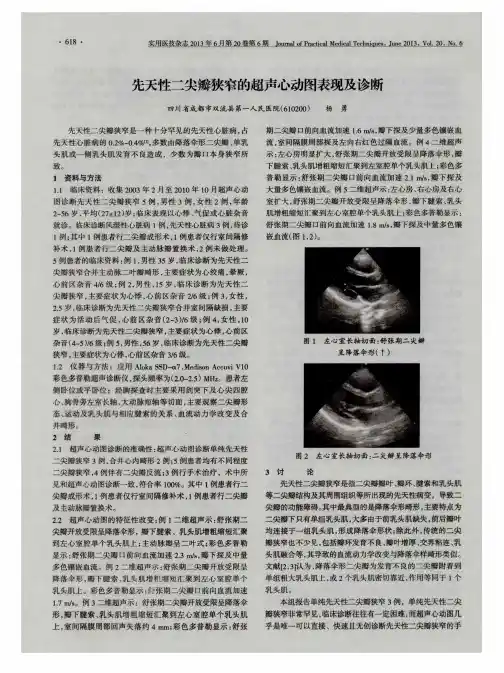 先天性二尖瓣狭窄的超声心动图表现及诊断