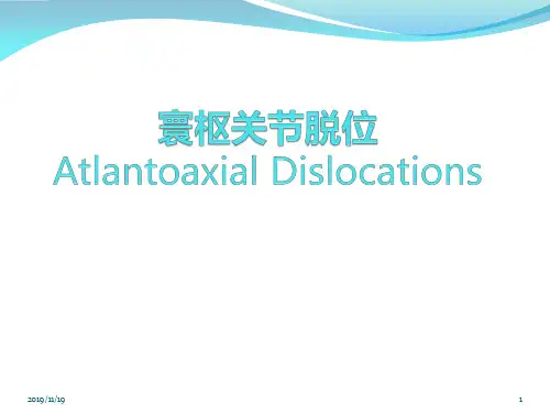 寰枢关节脱位PPT课件