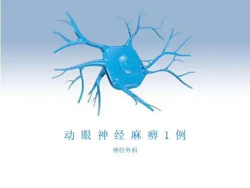动眼神经麻痹一例