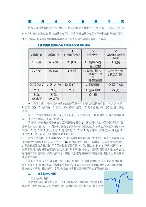 起搏器心电图判读