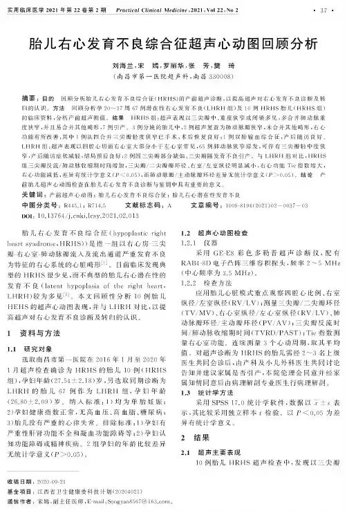 胎儿右心发育不良综合征超声心动图回顾分析