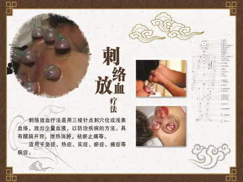 刺络疗法
