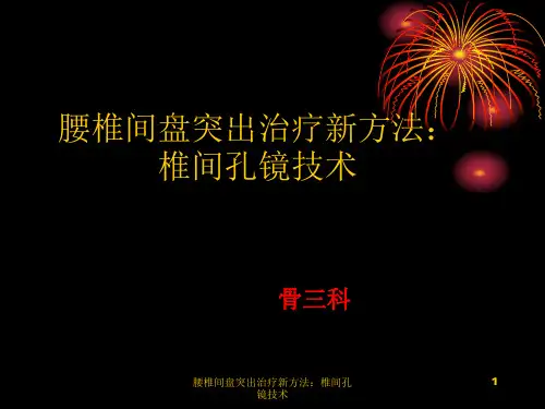 腰椎间盘突出治疗新方法：椎间孔镜技术ppt课件