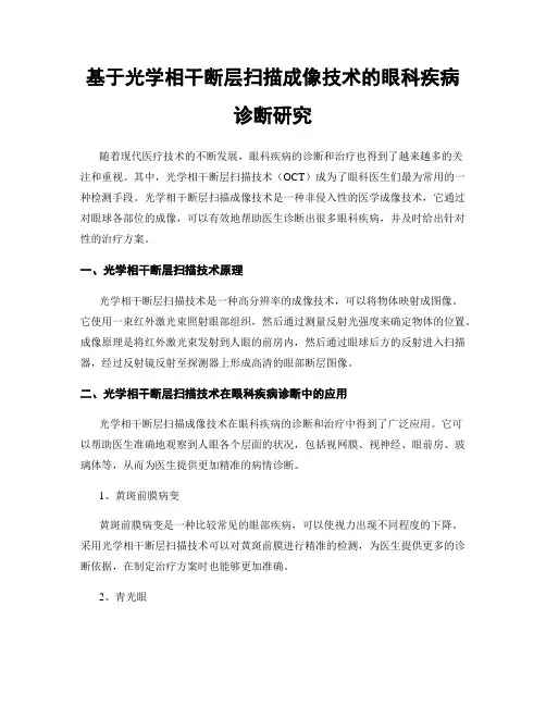 基于光学相干断层扫描成像技术的眼科疾病诊断研究