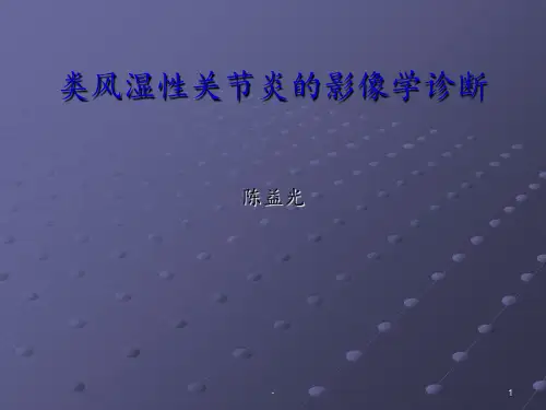 类风湿性关节炎的影像学诊断ppt课件