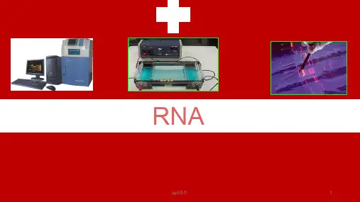 人类细胞质RNA提取、RT-PCR的原理、方法、琼脂糖凝胶电泳结果分析及其应用  ppt课件