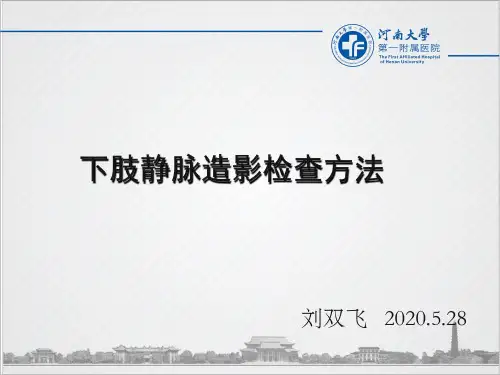 下肢静脉造影方法