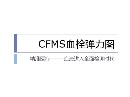 血栓弹力图知识课件