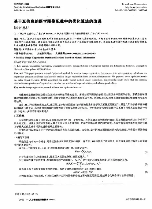 基于互信息的医学图像配准中的优化算法的改进