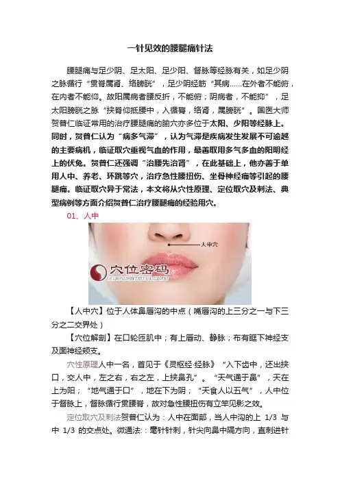 一针见效的腰腿痛针法