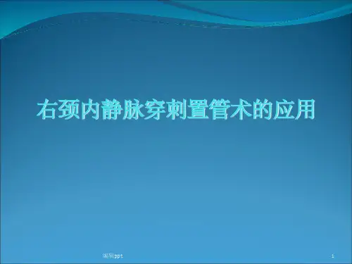 右颈内静脉穿刺置管术的应用