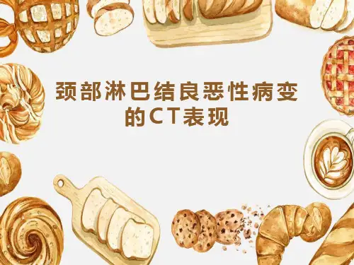 颈部淋巴结良恶性病变的影像表现