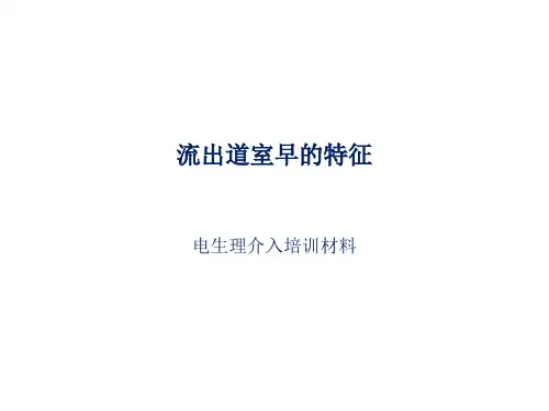 流出道室早特征