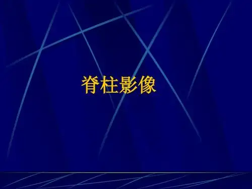 脊柱影像