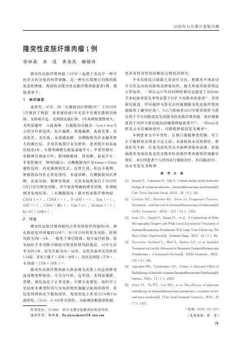 隆突性皮肤纤维肉瘤1例