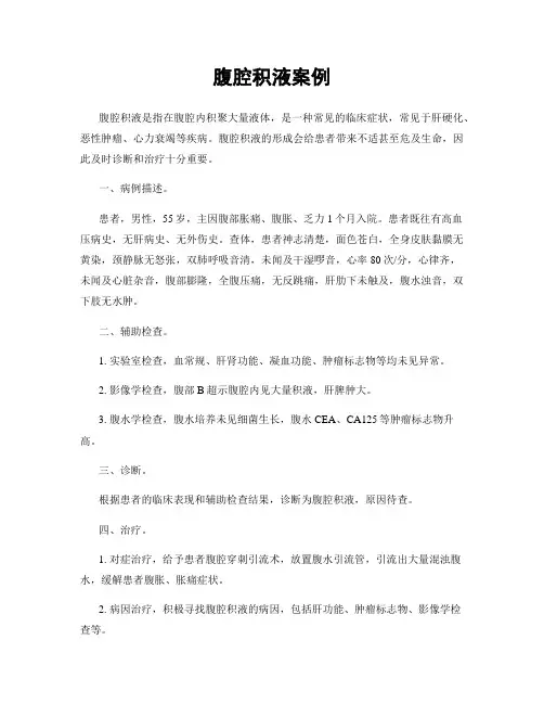 腹腔积液案例