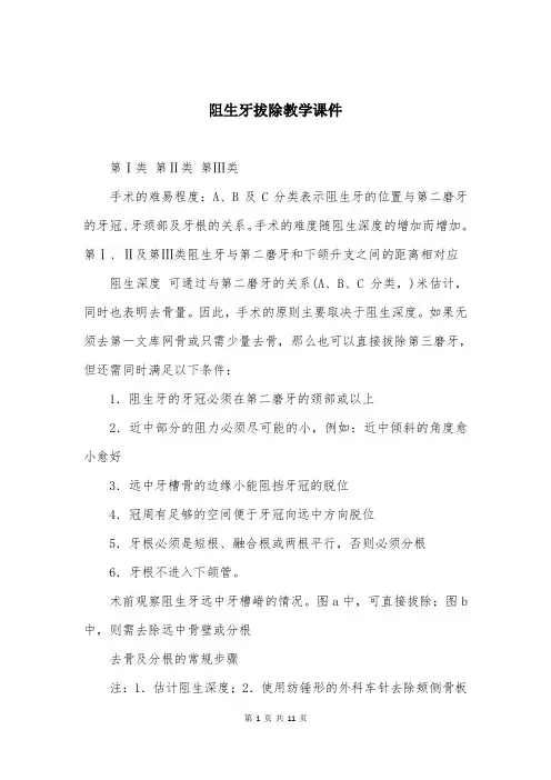 阻生牙拔除教学课件