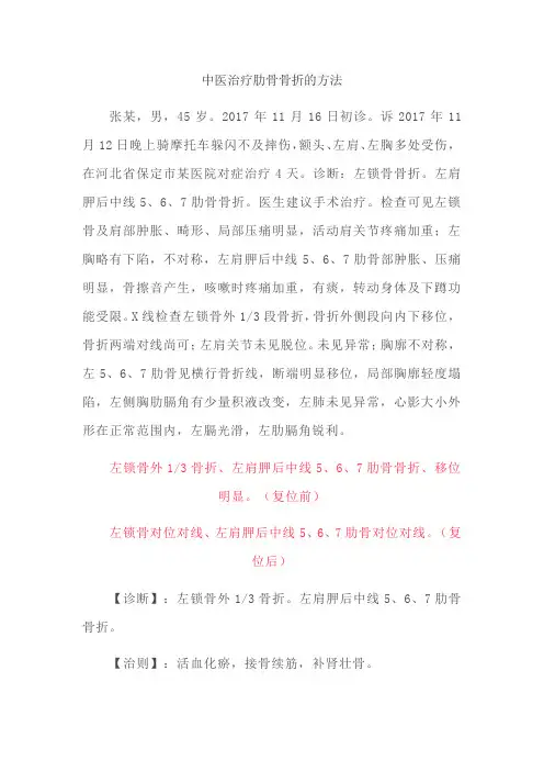 中医治疗肋骨骨折的方法