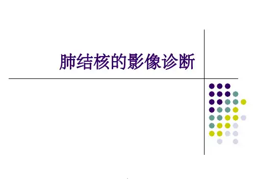 肺结核的影像诊断(X线)最新版本