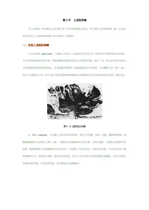 第八节上皮性肿瘤一、良性上皮组织肿瘤
