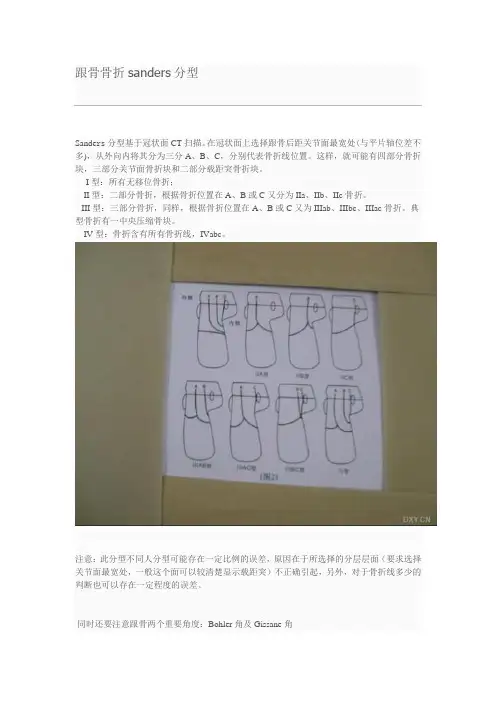 跟骨Sander分型