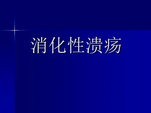消化性溃疡.