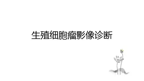 生殖细胞瘤影像诊断