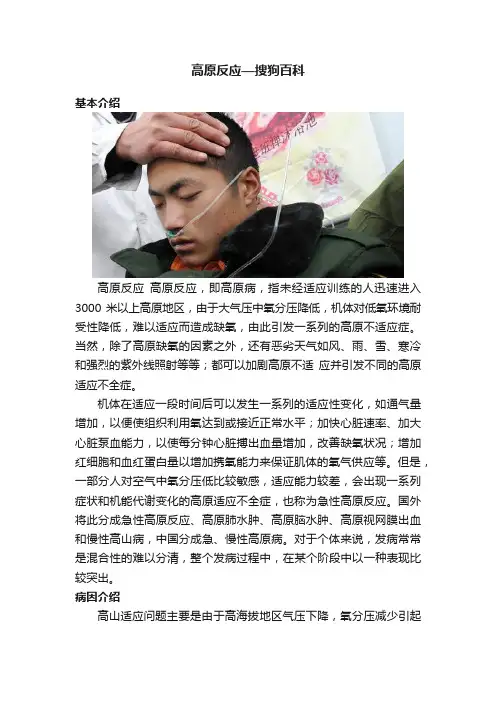 高原反应—搜狗百科