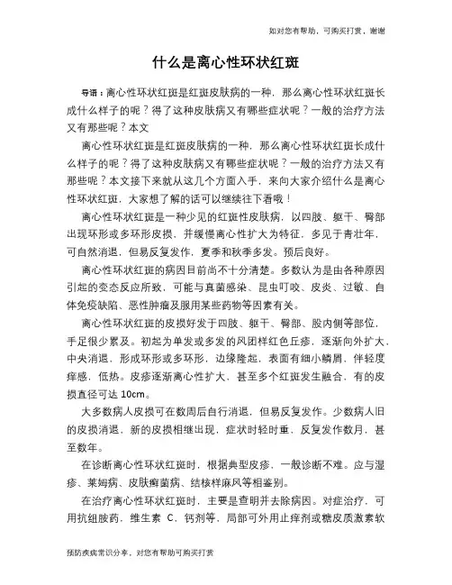 什么是离心性环状红斑