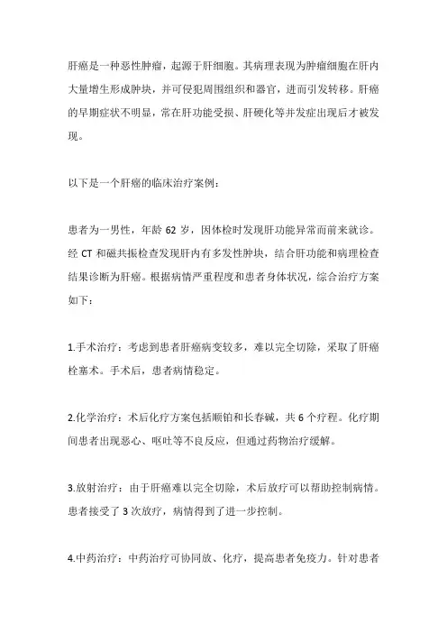 肝癌临床治疗案例