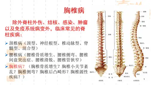 胸椎病诊断与治疗PPT课件