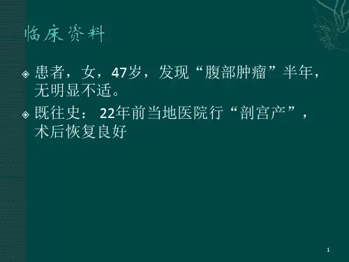 腹膜后巨淋巴结增生PPT课件