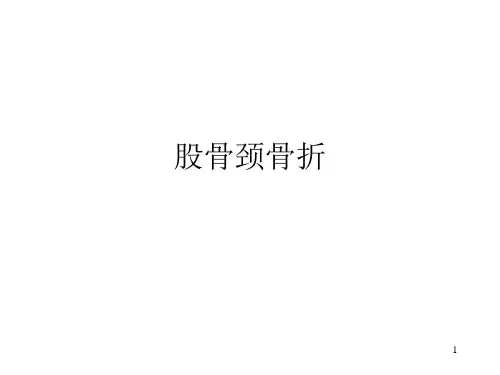 股骨颈骨折PPT课件