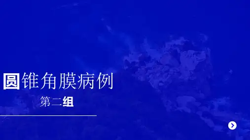 圆锥角膜病例