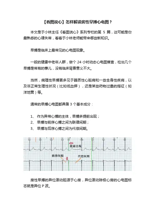 【看图说心】怎样解读房性早搏心电图？
